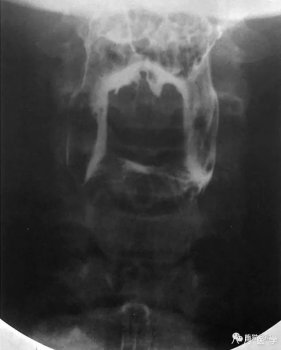 超详细的消化道造影解剖图谱