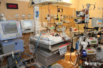 ECMO患者在ICU的那些事儿（下）